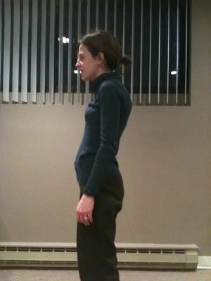 Posture before care, side view